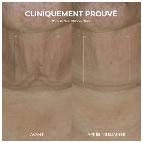 RoC Derm Correxion Firming Serumstick