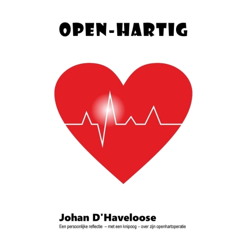 OPEN-HARTIG (Paperback)