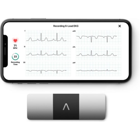 Kardia Mobile 6-kanaals ECG monitor