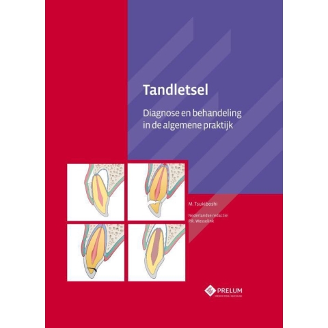 Tandletsel (Hardback)