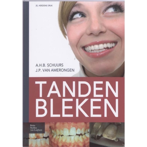 Tanden bleken (Paperback)