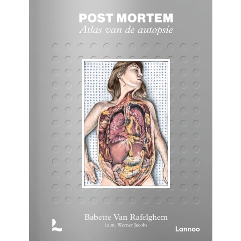 Post mortem. Atlas van de autopsie (Hardback)