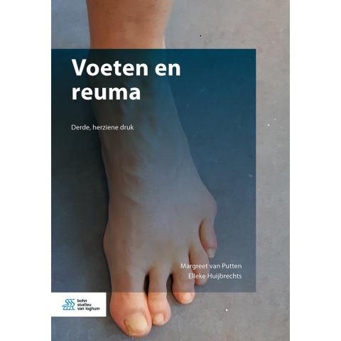 Voeten en reuma (Paperback)