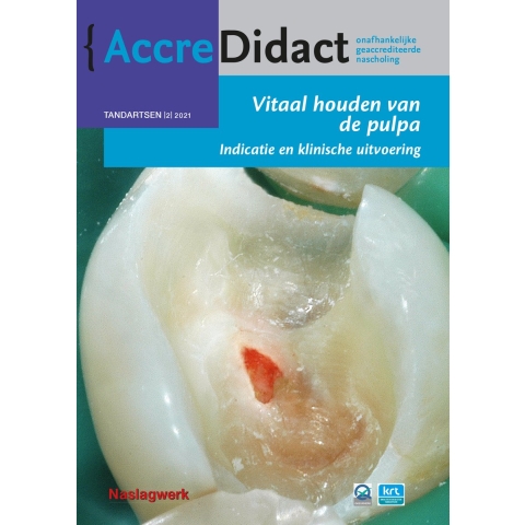 Vitaal houden van de pulpa (Paperback)