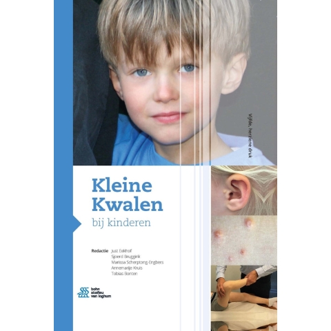Kleine Kwalen bij kinderen (Hardback)