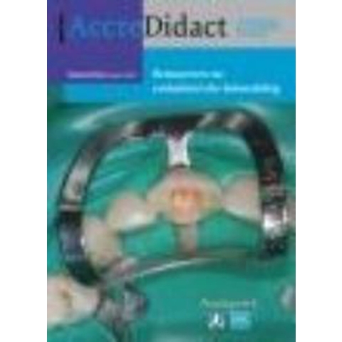 Restaureren na endodontische behandeling (Paperback)