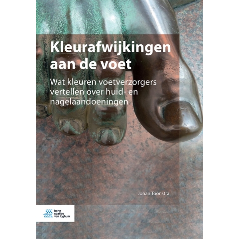 Kleurafwijkingen aan de voet (Paperback)