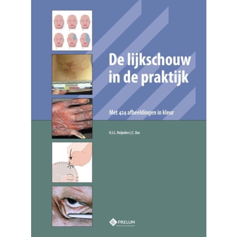 De lijkschouw in de praktijk (Hardback)