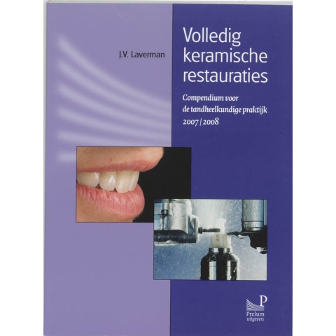 Volledig keramische restauraties (Paperback)