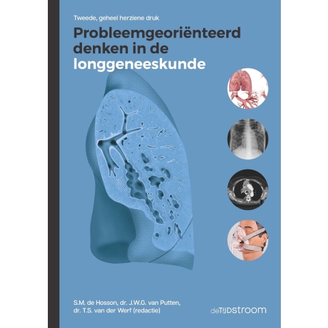 Probleemgeoriënteerd denken in de longgeneeskunde (Hardback)
