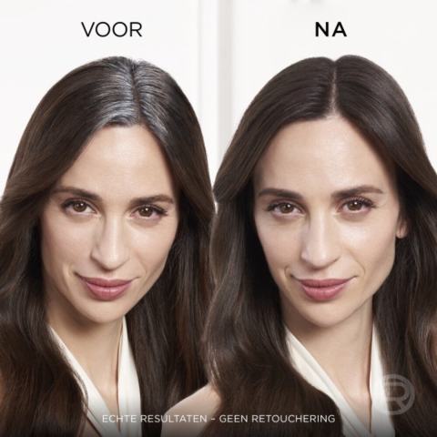 3x L'Oréal Magic Retouch Uitgroeispray Donkerblond 75 ml
